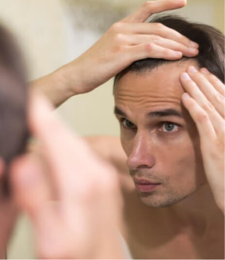 man hair loss - Slimbolic man hair loss