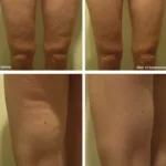 SlimbolicBeforeAfterA-1920w