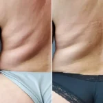 SlimbolicBeforeAfterB-1920w