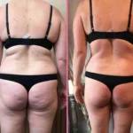SlimbolicBeforeAfterD-1920w